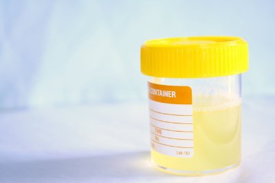 Picture of Urine Culture Test