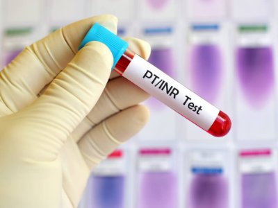 Show details for PT/INR Blood Clotting Test