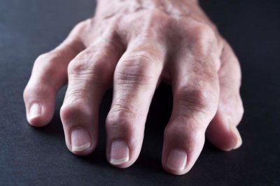 Show details for Rheumatoid Arthritis Test